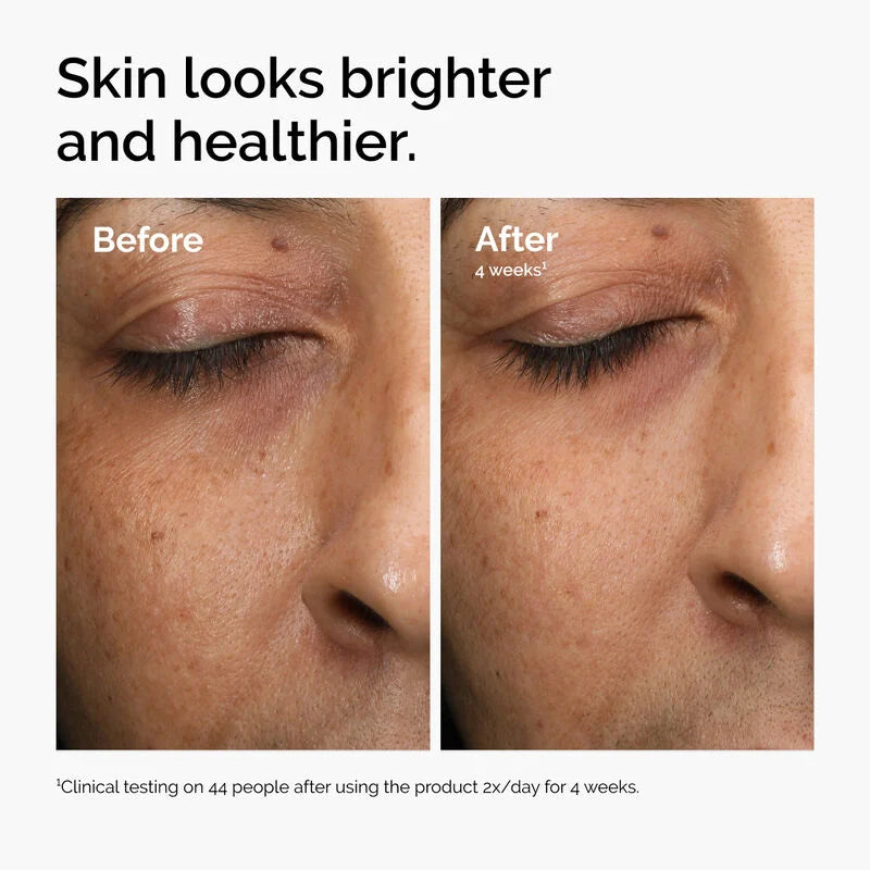 The Ordinary Serum Antioxidante Radiance - 30 ml