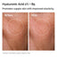 The Ordinary Set Serum Niacinamida + Serum Ácido Hialurónico - 30ml x 2 unidades