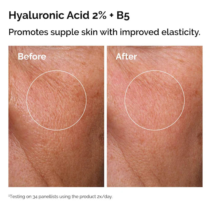 The Ordinary Set Serum Niacinamida + Serum Ácido Hialurónico - 30ml x 2 unidades