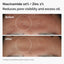 The Ordinary Set Serum Niacinamida + Serum Ácido Hialurónico - 30ml x 2 unidades