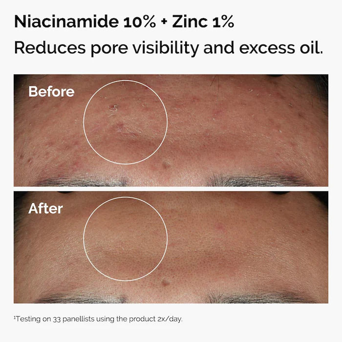 The Ordinary Set Serum Niacinamida + Serum Ácido Hialurónico - 30ml x 2 unidades