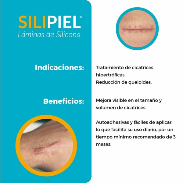 Silipiel Lamina de Silicona Para Cicatrices 4x6 cm - 1 Lámina
